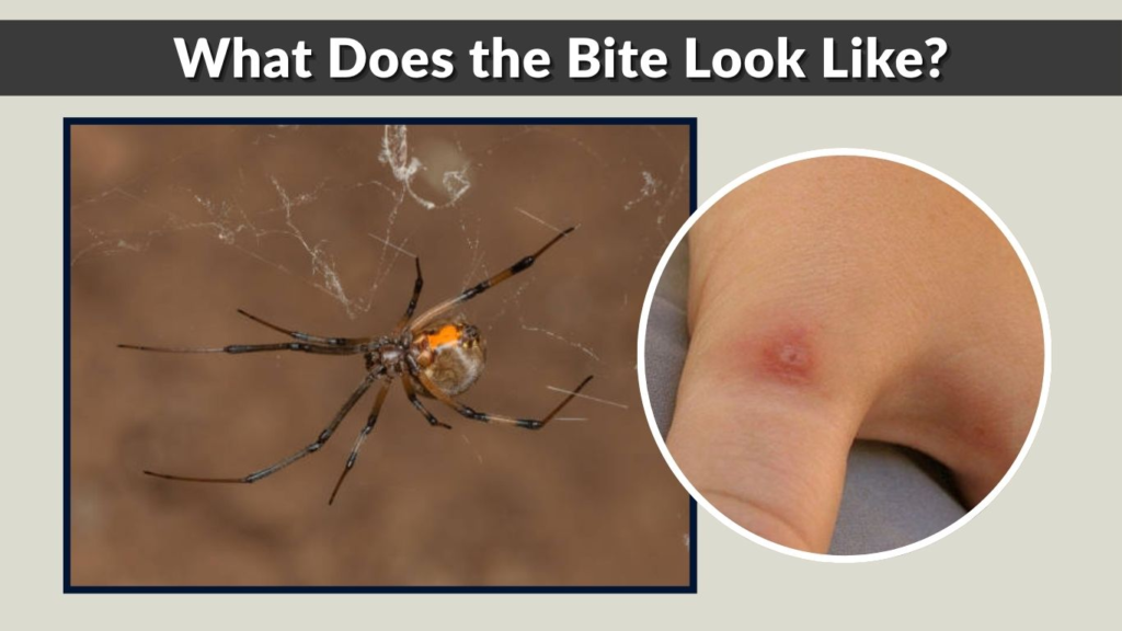 What Does the Bite Look Like?