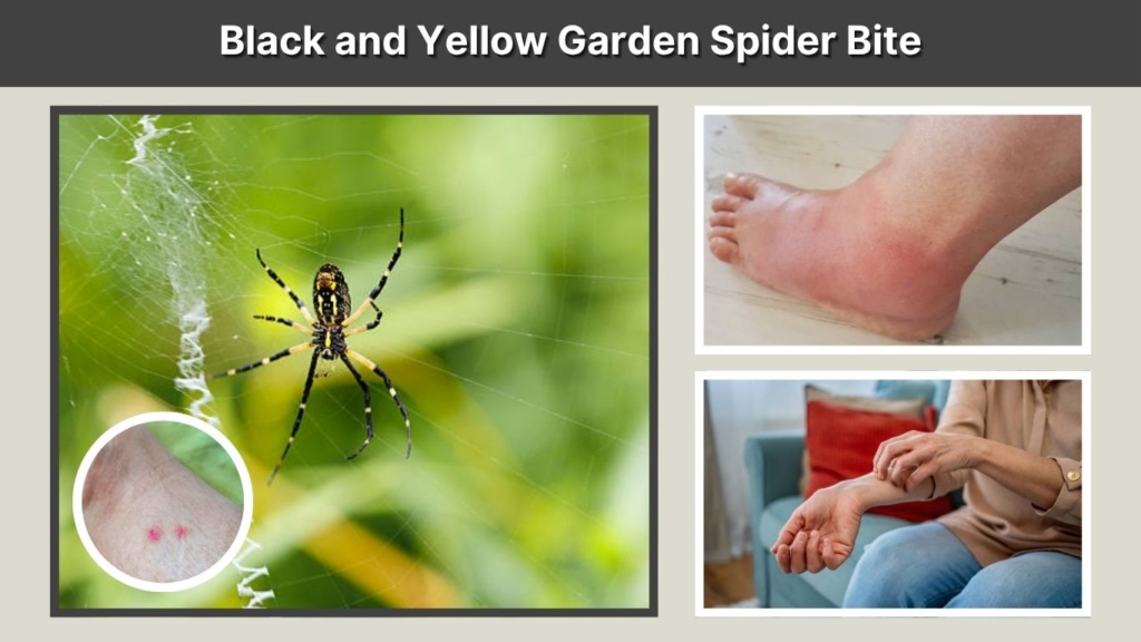 Black and Yellow Garden Spider Bite