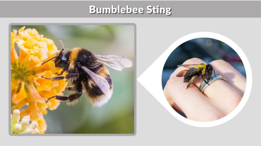 Bumblebee Sting