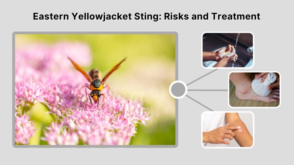 Eastern Yellowjacket Sting: Risks and Treatment
