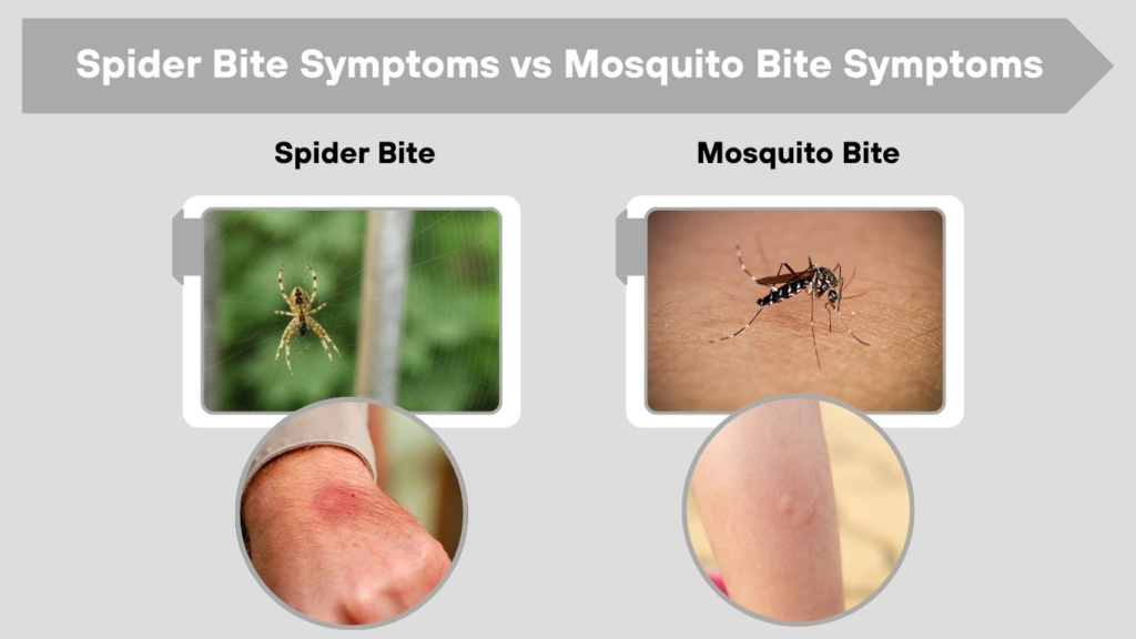 Spider Bite Symptoms vs Mosquito Bite Symptoms