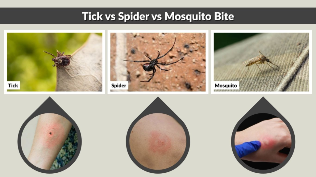 Tick vs Spider vs Mosquito Bite