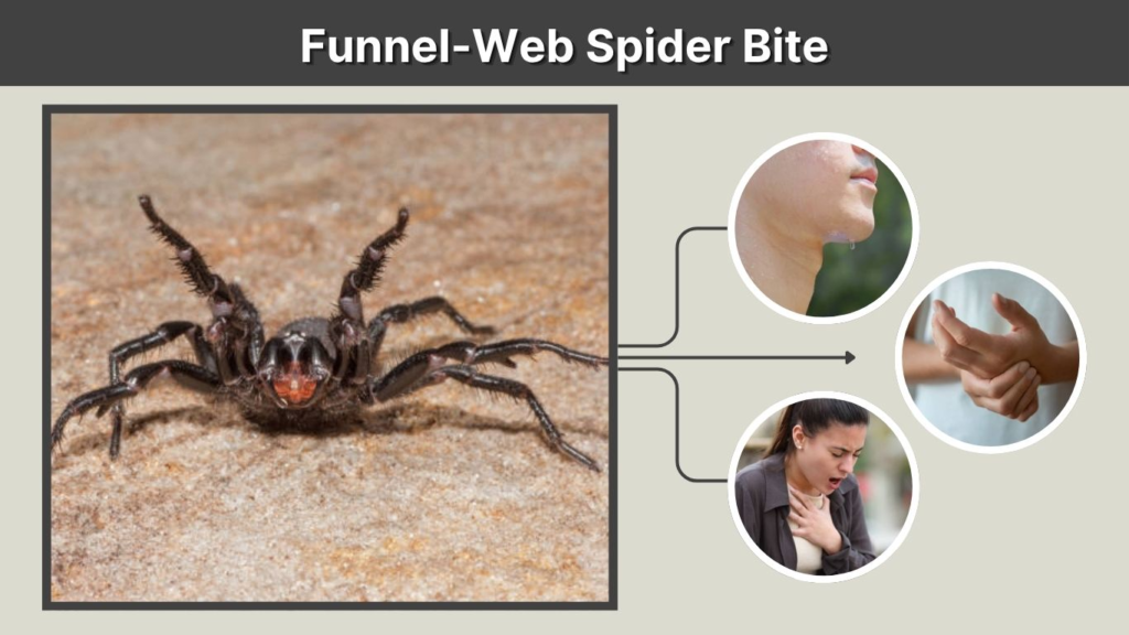 Funnel-Web Spider Bite