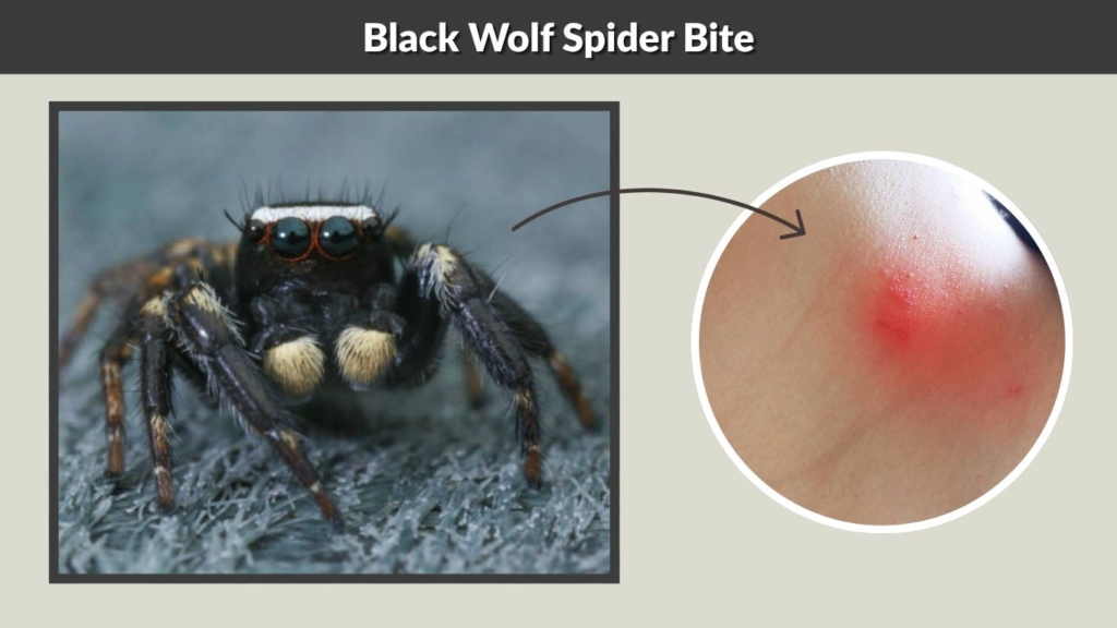 Black Wolf Spider Bite