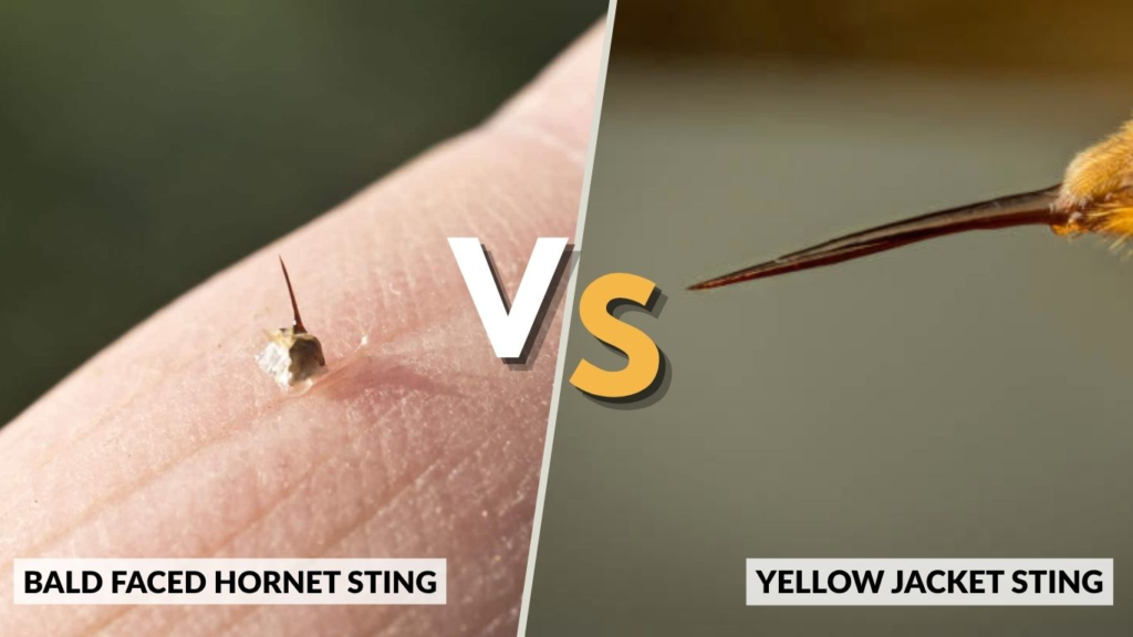 Bald Faced Hornet Sting vs Yellow Jacket