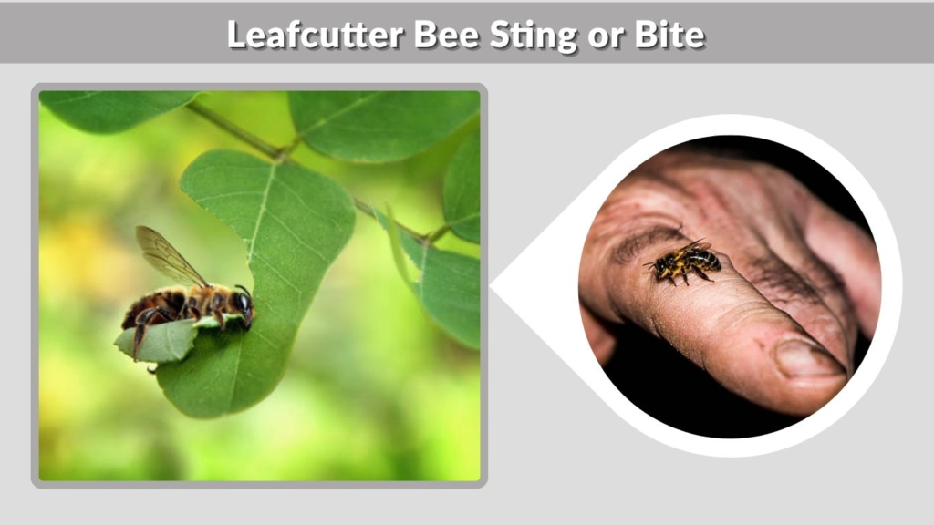 Leafcutter Bee Sting or Bite