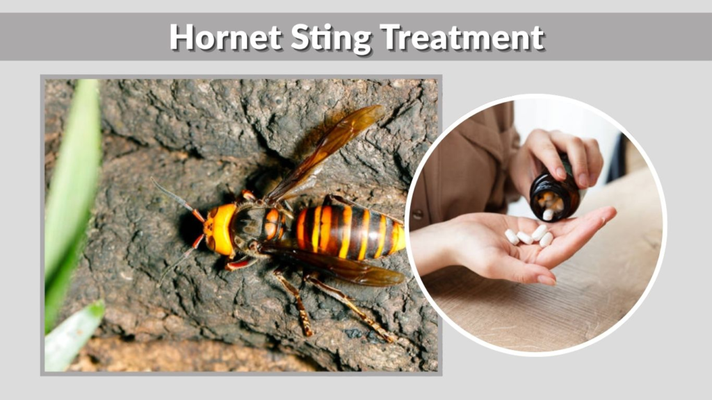 Hornet Sting Treatment