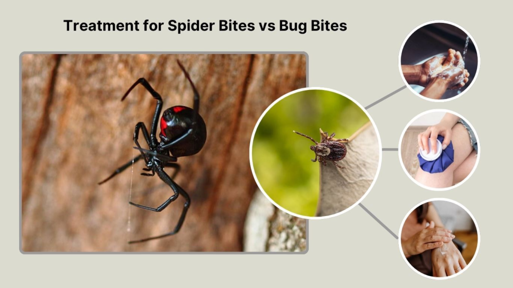 Treatment for Spider Bites vs Bug Bites