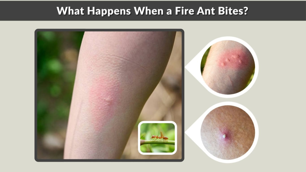 What Happens When a Fire Ant Bites?