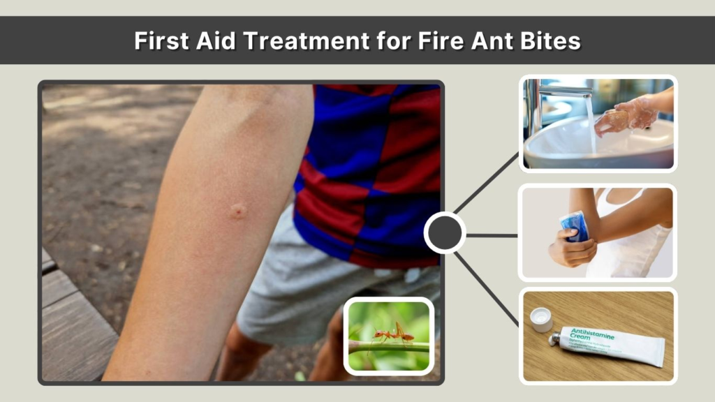 First Aid Treatment for Fire Ant Bites