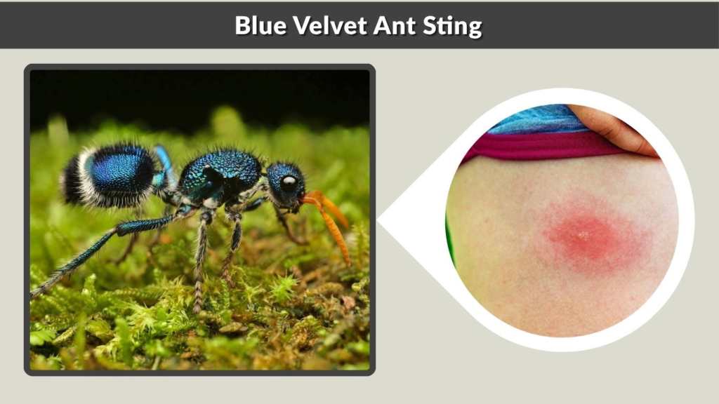 Blue Velvet Ant Sting