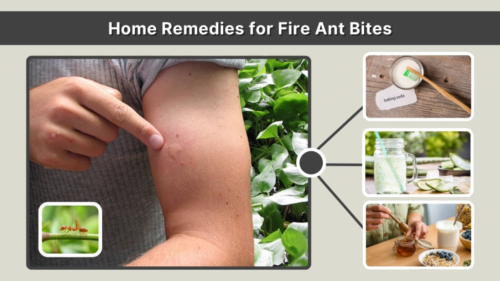 Home Remedies for Fire Ant Bites