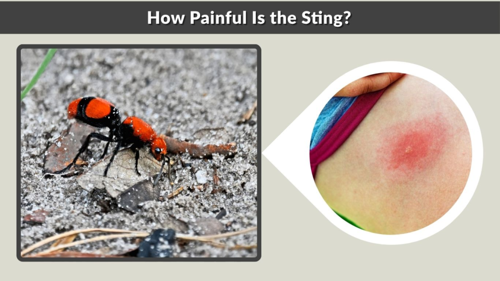 How Painful Is the Sting?