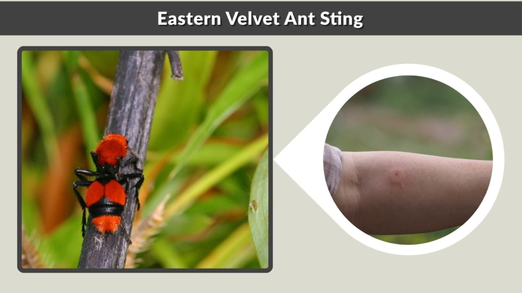 Eastern Velvet Ant Sting