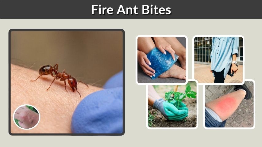 Fire Ant Bites: Symptoms, Treatment and Relief Tips