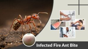 Infected Fire Ant Bite: Signs, Treatment and Care