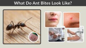 What Do Ant Bites Look Like? Signs, Types and Symptoms
