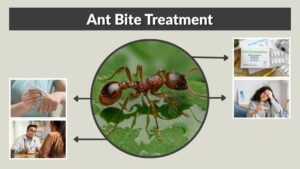 Ant Bite Treatment: How to Stop Itching, Pain and Swelling