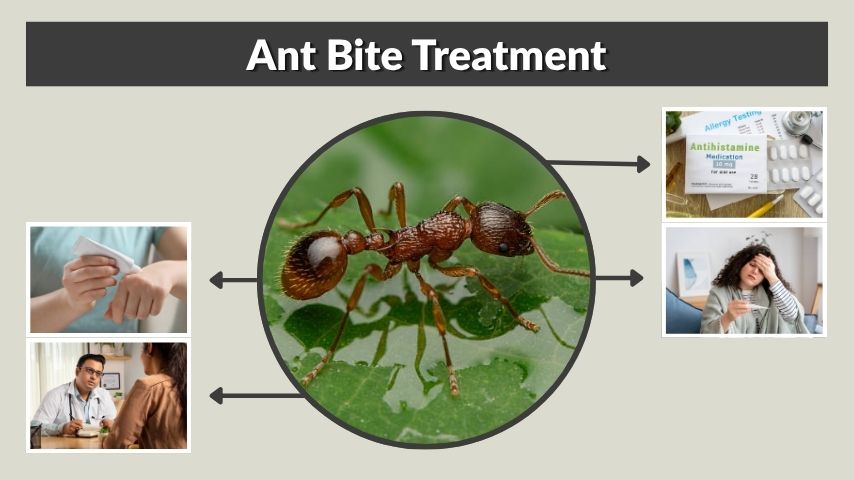 Ant Bite Treatment: How to Stop Itching, Pain and Swelling