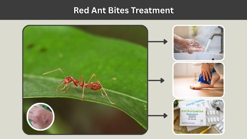 Red Ant Bites Treatment