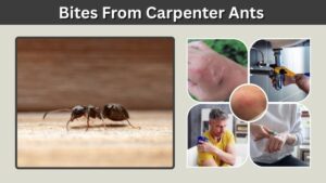 Bites From Carpenter Ants: Symptoms, Look and Treatment