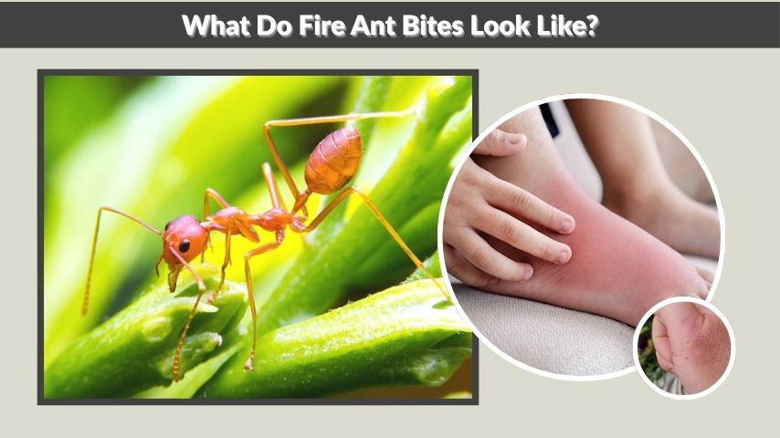 What Do Fire Ant Bites Look Like?