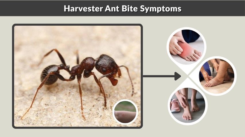 Harvester Ant Bite Symptoms