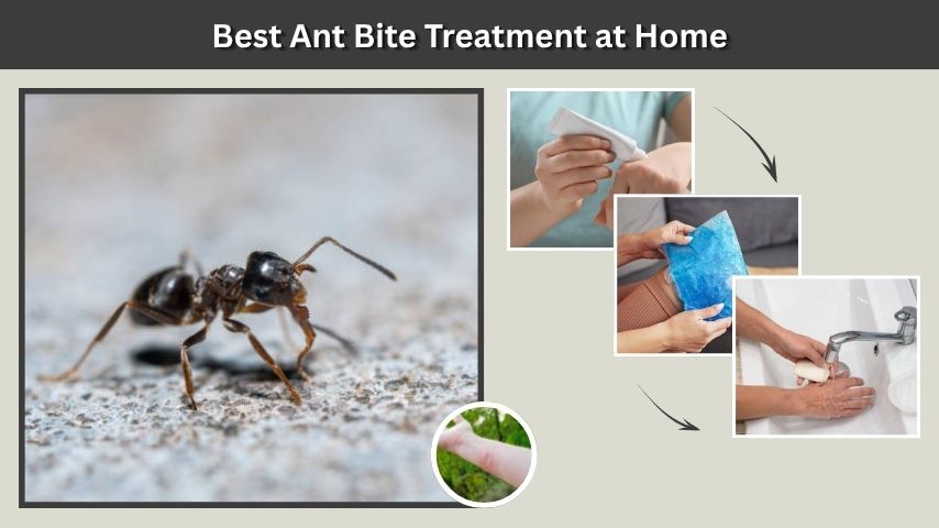 Best Ant Bite Treatment at Home