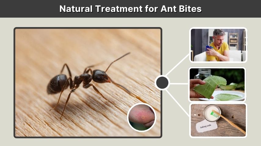 Natural Treatment for Ant Bites
