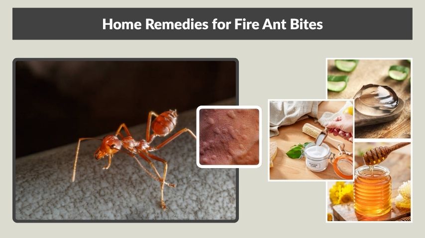 Home Remedies for Fire Ant Bites