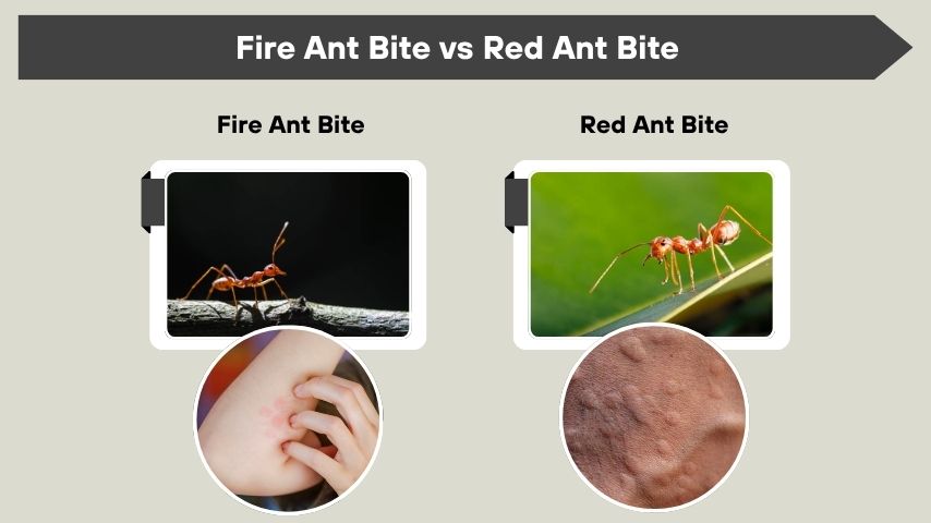 Fire Ant Bite vs Red Ant Bite