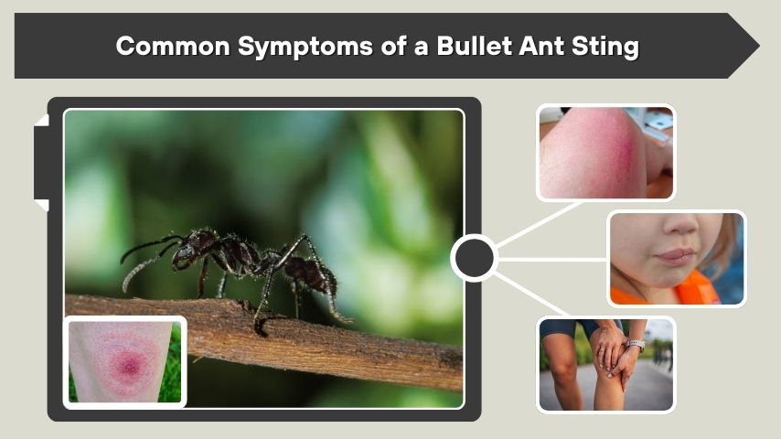 Common Symptoms of a Bullet Ant Sting