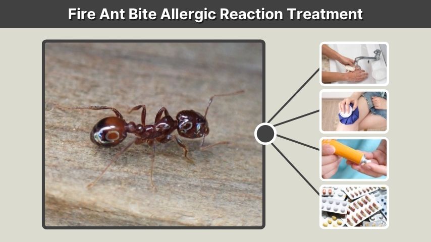 Fire Ant Bite Allergic Reaction Treatment