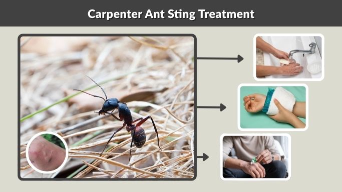 Carpenter Ant Sting Treatment