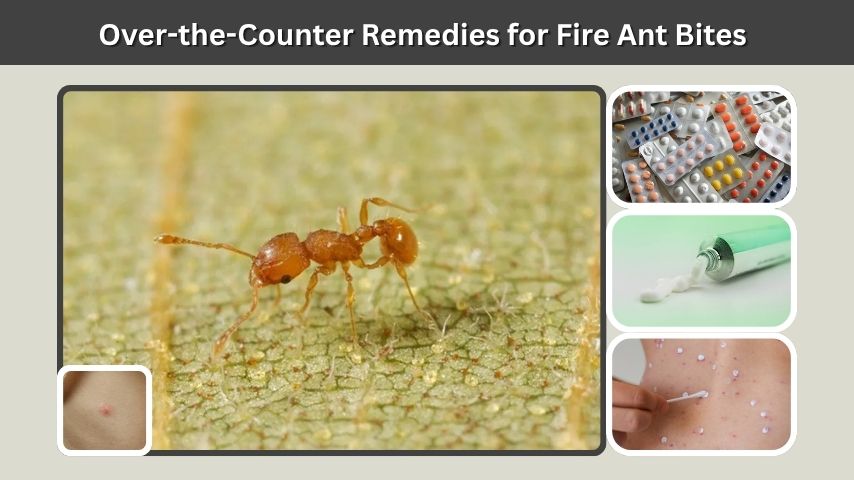 Over-the-Counter Remedies for Fire Ant Bites