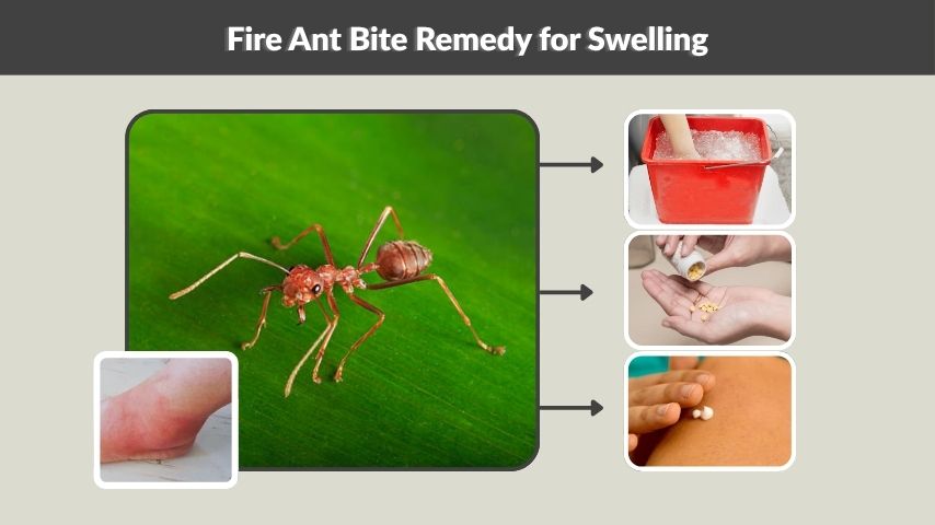 Fire Ant Bite Remedy for Swelling