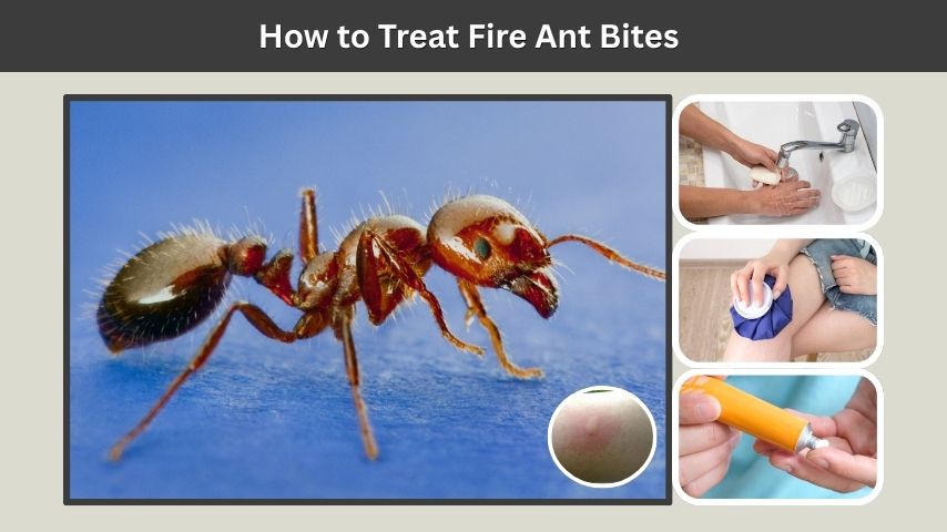 How to Treat Fire Ant Bites