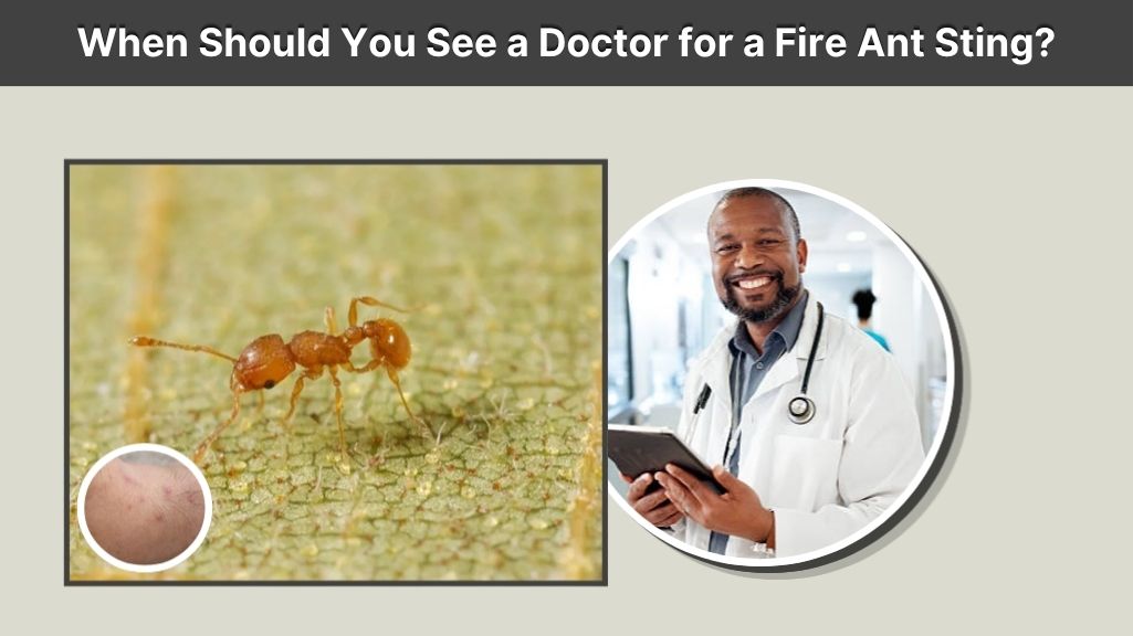 When Should You See a Doctor for a Fire Ant Sting?