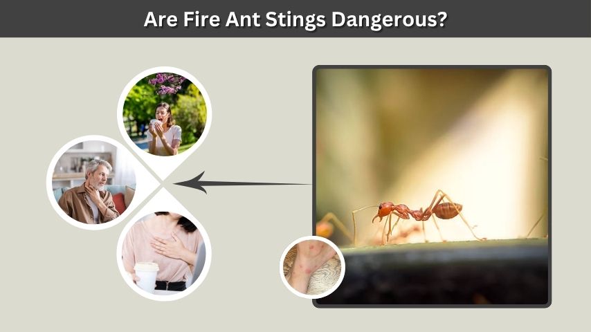 Are Fire Ant Stings Dangerous?