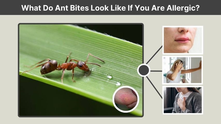 What Do Ant Bites Look Like If You Are Allergic?