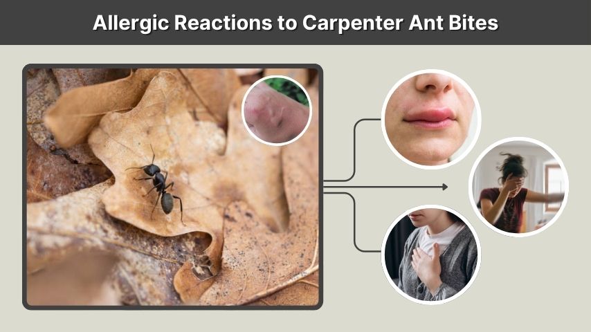 Allergic Reactions to Carpenter Ant Bites