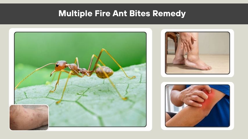 Multiple Fire Ant Bites Remedy