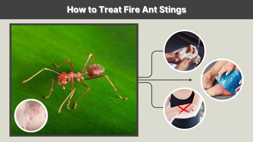 How to Treat Fire Ant Stings