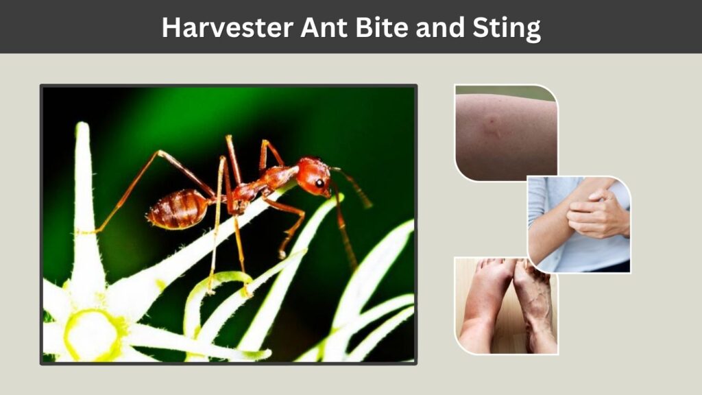 Harvester Ant Bite and Sting
