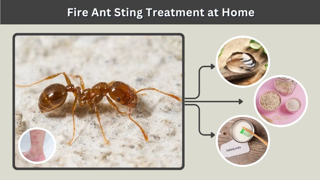 Fire Ant Sting Treatment at Home