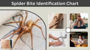 Spider Bite Identification Chart: Symptoms, Pain & Risks