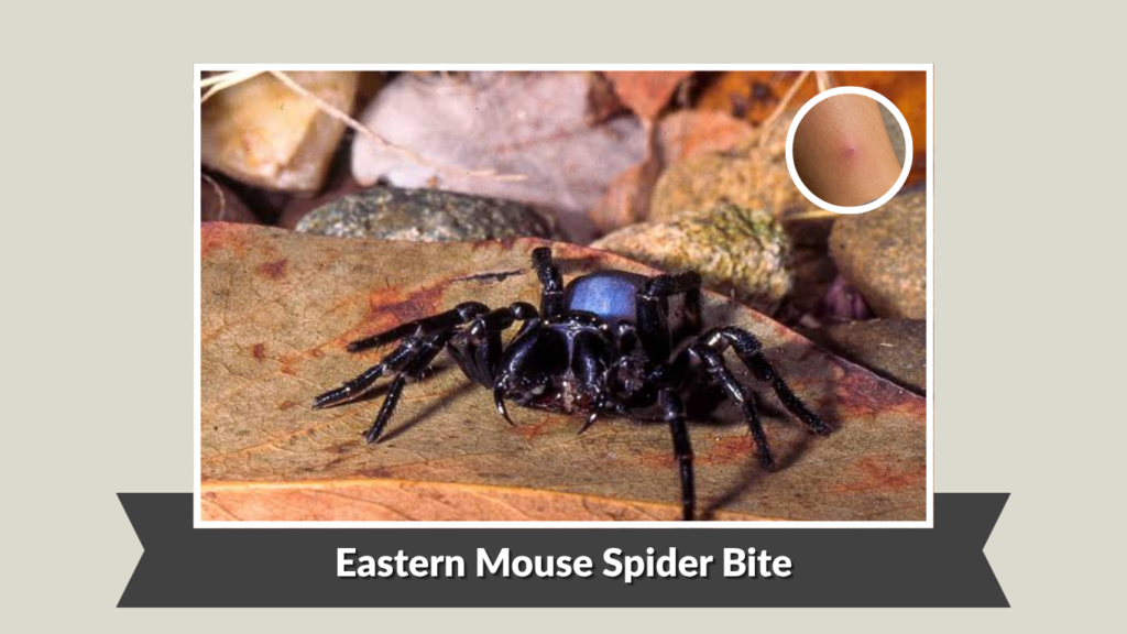 Eastern Mouse Spider Bite