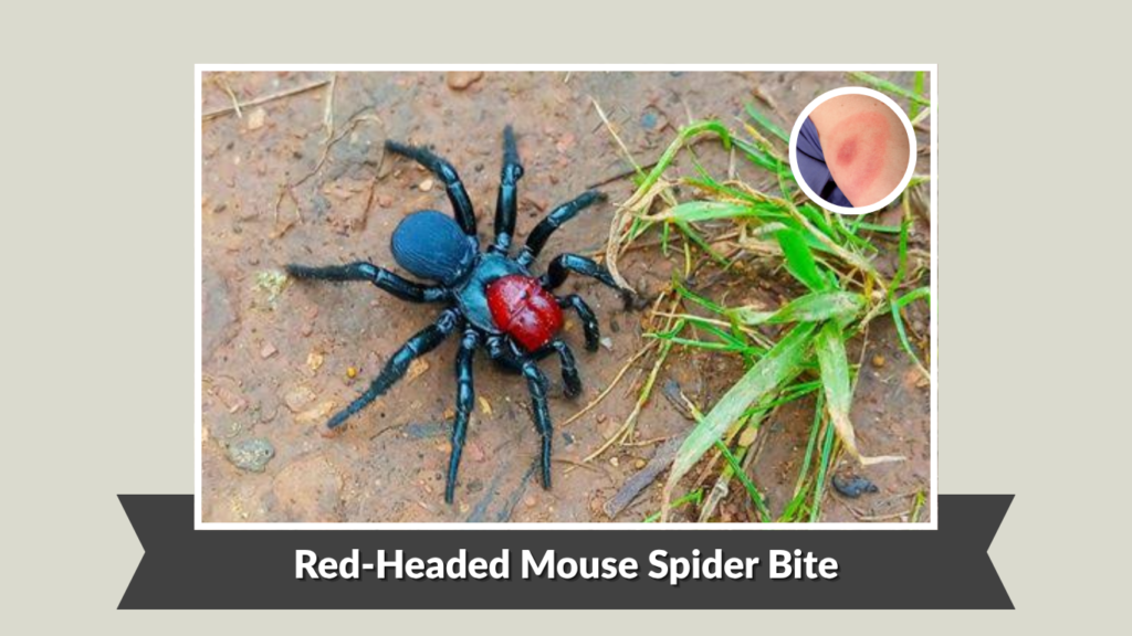 Red-Headed Mouse Spider Bite