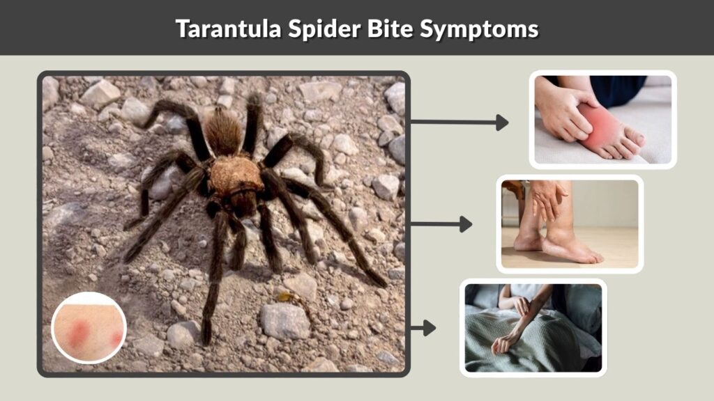 Tarantula Spider Bite Symptoms
