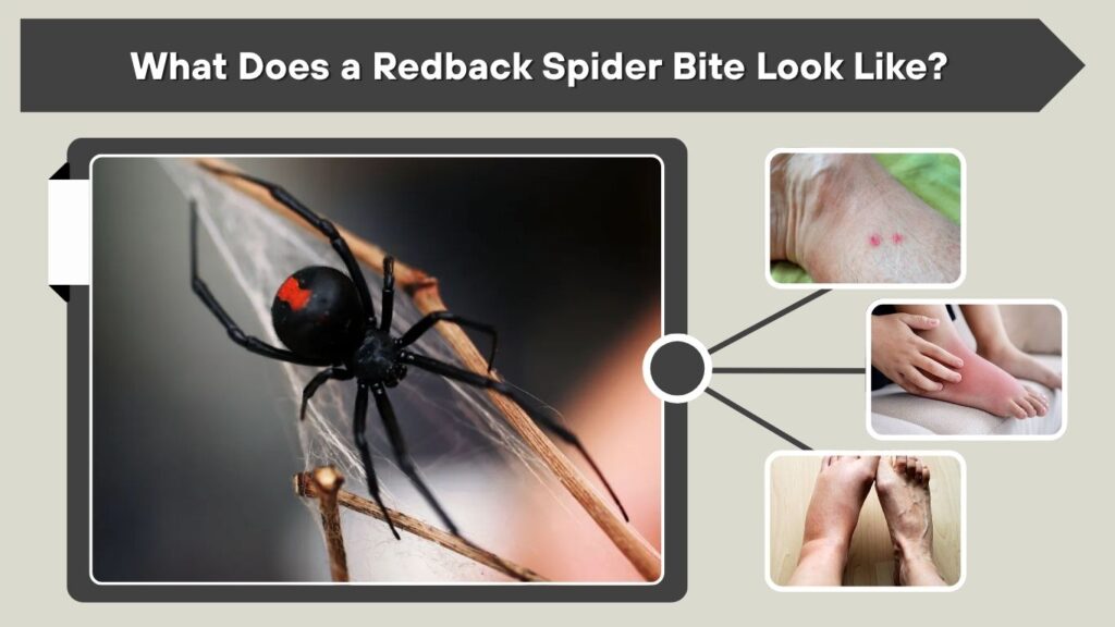 What Does a Redback Spider Bite Look Like?